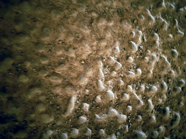 popcorn ceiling